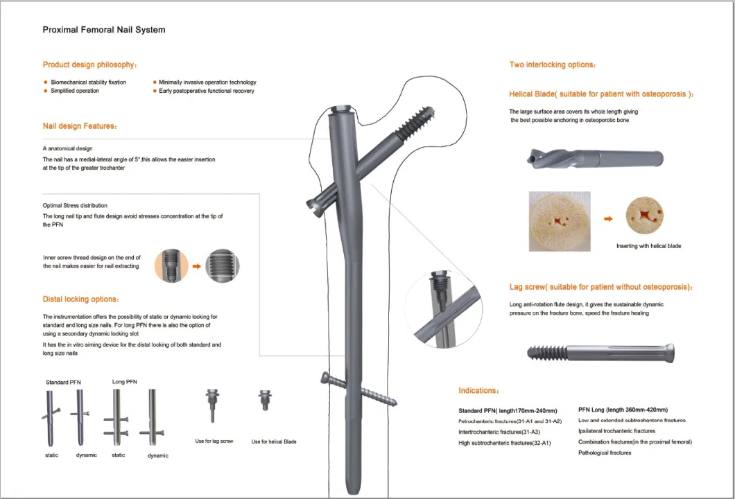 Orthopedic Pfna Intramedullary Nail Implants, Femoral Interlocking Nail, Femoral Fixation Orthopedic Nails